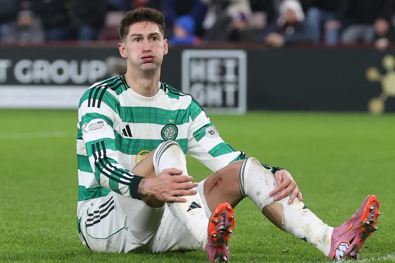 ‘Holding His Hamstring’ Celtic Handed Early Tomas Cvancara Injury Concern